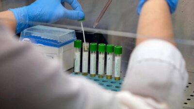 Allerta polio in Germania virus selvaggio trovato in acque reflue ad Amburgo