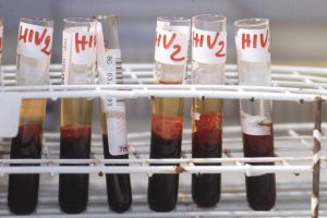 Aids, scoperti ‘codici’ del sistema immunitario per sospendere le cure