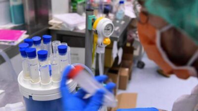 Legionella il batterio che ama tubature e condizionatori casi in aumento in Italia