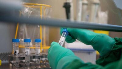 Tumori lo studio scoperto interruttore molecolare per riconvertire le cellule maligne