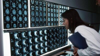 Cancro 4 sintomi insoliti che bisogna conoscere parola di oncologo