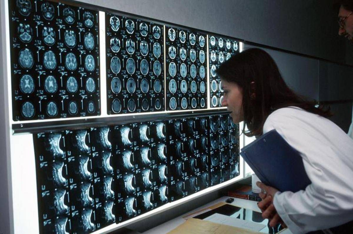 Cancro 4 sintomi insoliti che bisogna conoscere parola di oncologo