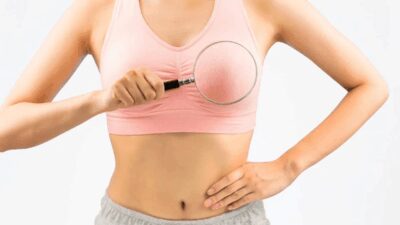 Cancro seno con test genomici 48 ricorso a chemioterapia