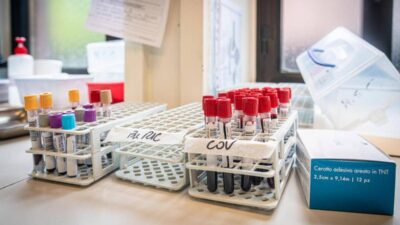 Medicina di laboratorio un semplice esame per scoprire in anticipo le patologie