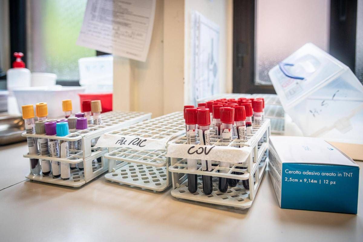 Medicina di laboratorio un semplice esame per scoprire in anticipo le patologie